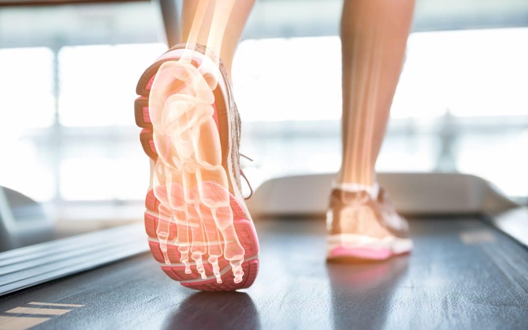 St. Louis Bone Spur Treatment | Horizon Foot & Ankle Institute