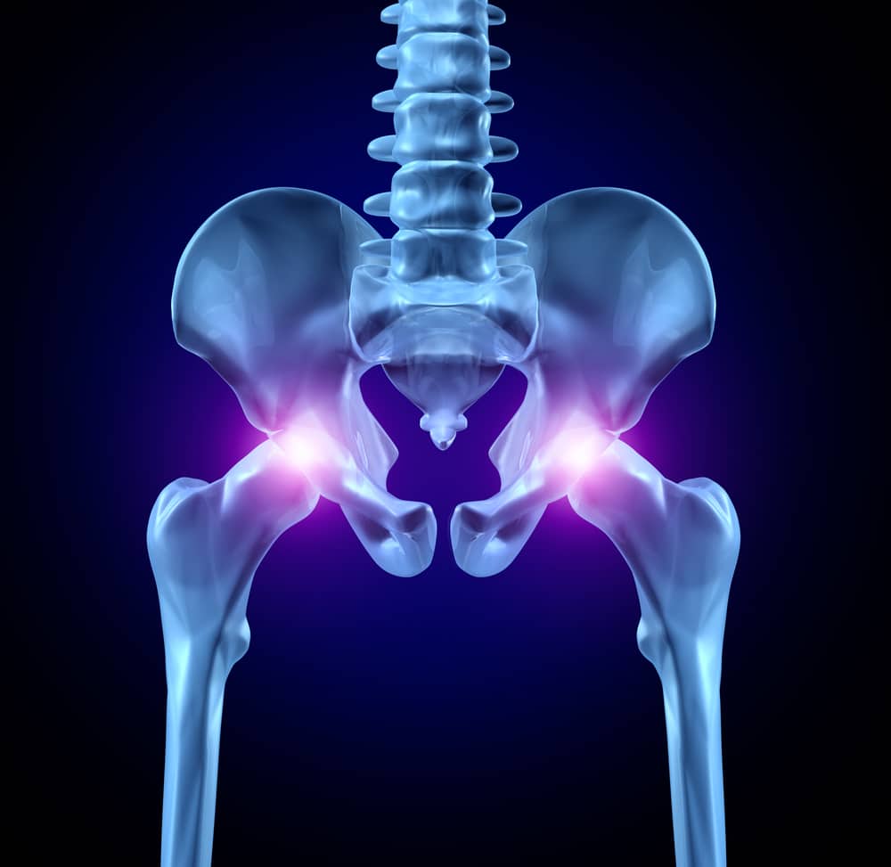 What Is Hip Joint Pain Called