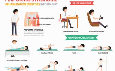 A Guide to Piriformis Syndrome